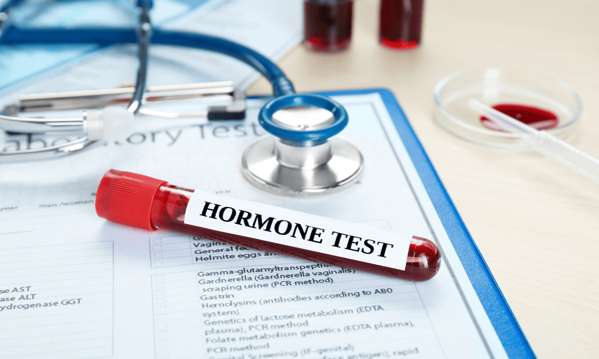 Hormonal Lab